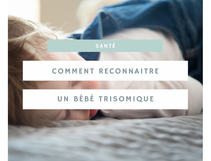 Comment détecter la trisomie 21 chez un bébé : signes et symptômes