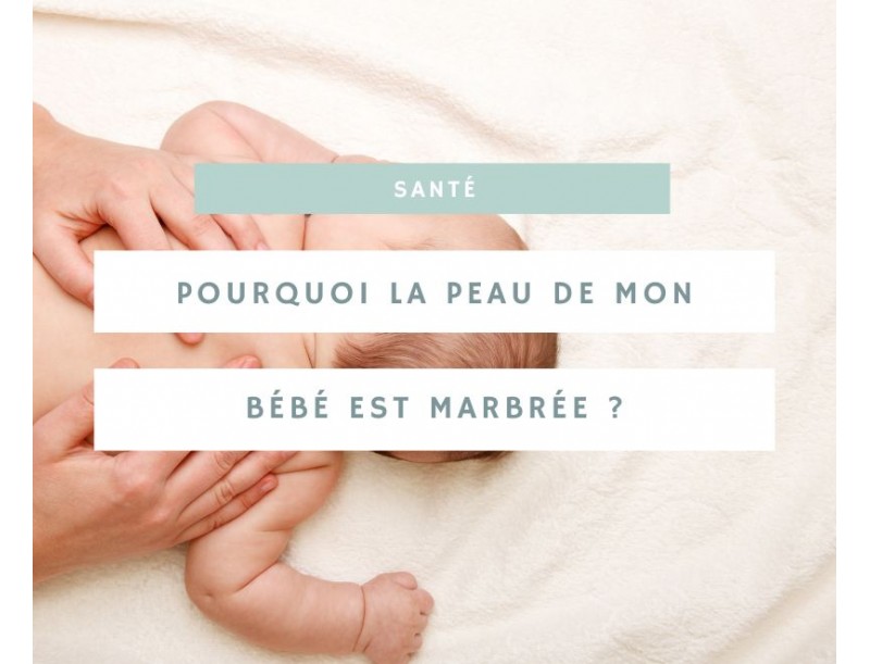 Peau marbrée bébé : comprendre et traiter ce phénomène courant