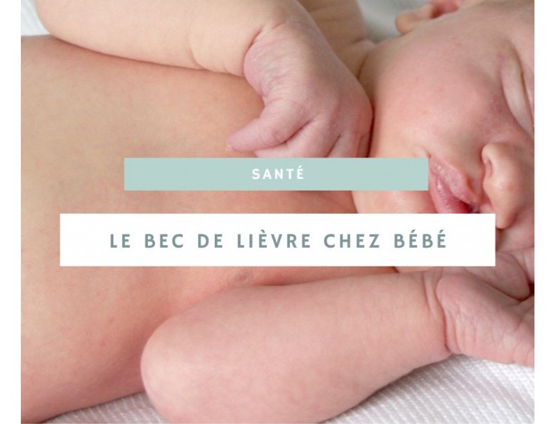 Tout savoir sur le bec de lièvre chez les bébés