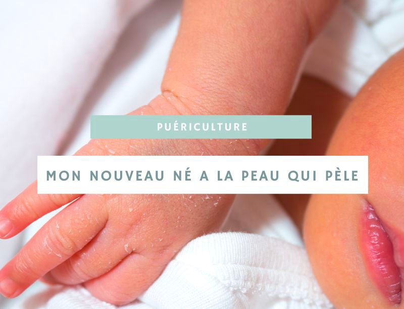 Peau de nouveau-né qui pèle : causes et solutions