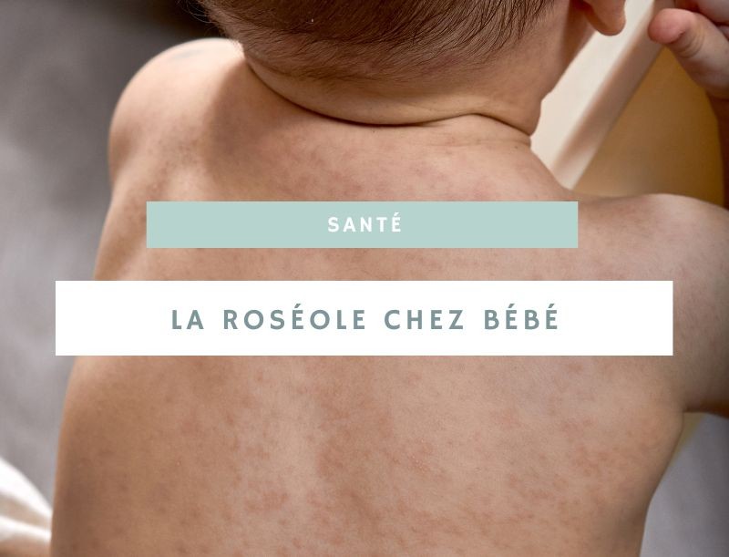La roséole chez bébé : tout ce que vous devez savoir