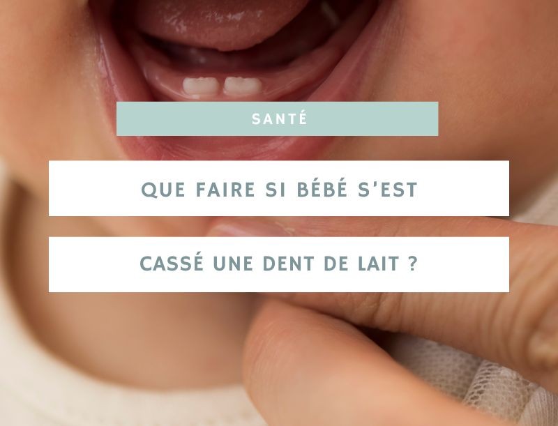 Que faire si votre bébé s’est cassé une dent de lait ?