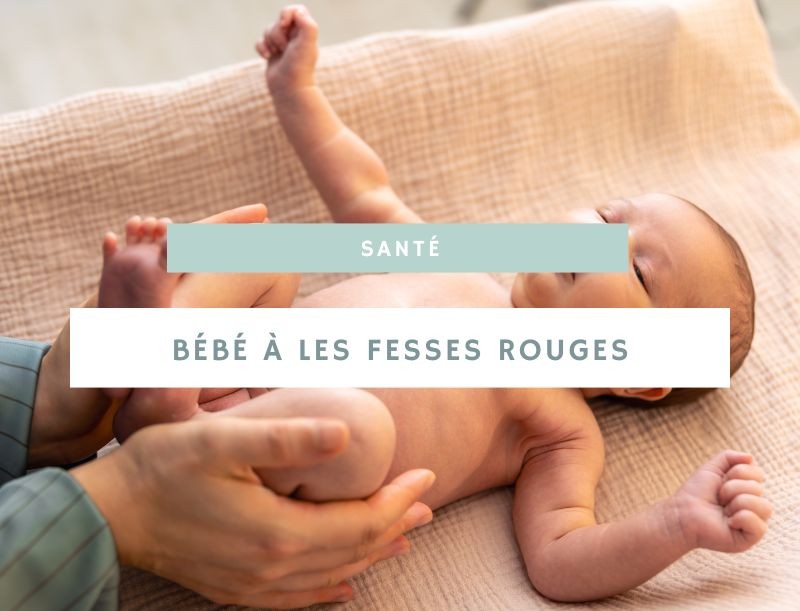 Comment gérer les fesses rouges de bébé : conseils et astuces efficaces